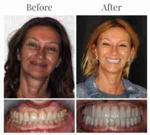 Dr. Marlen Martirossian DDS - This is River Edge